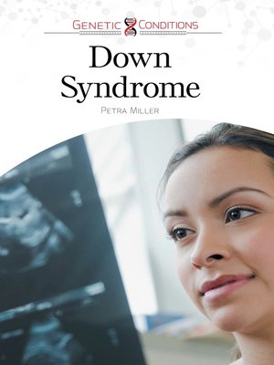 cover image of Down Syndrome